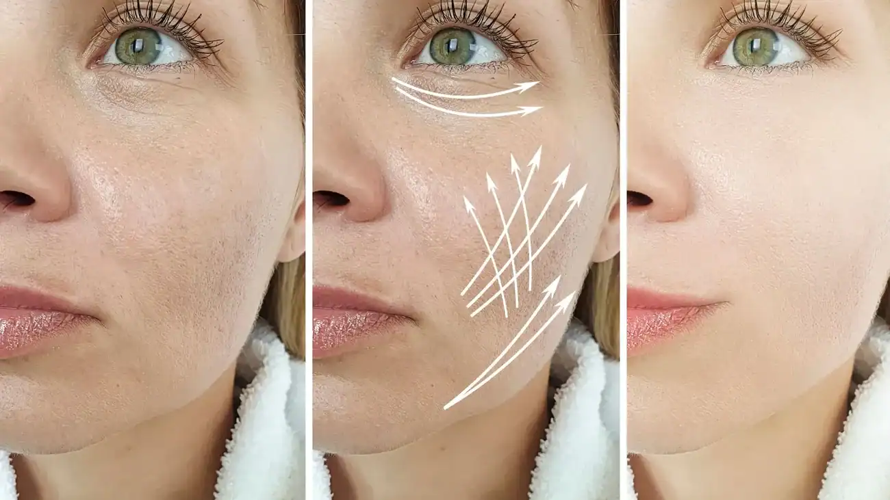 Can One Treatment Really Tackle More Than One Skin Concern Sittingbourne?