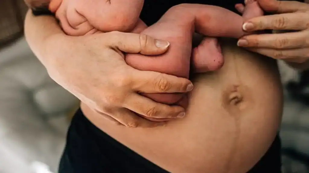 Why Is My Stomach Still Big After Pregnancy Sittingbourne?